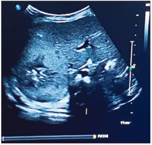 CC-523-fig2 | Revista ACTA